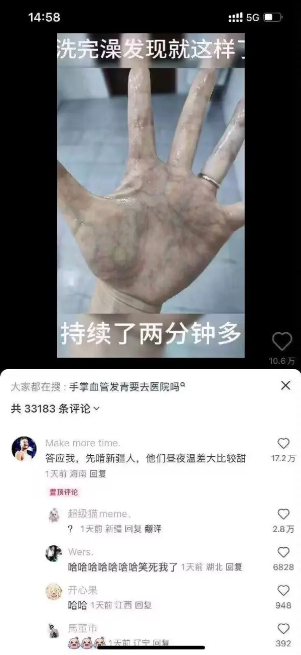 今日沙雕：把自己的棵体印在衣服上穿出去，算穿了衣服还是没穿衣服宣传图50